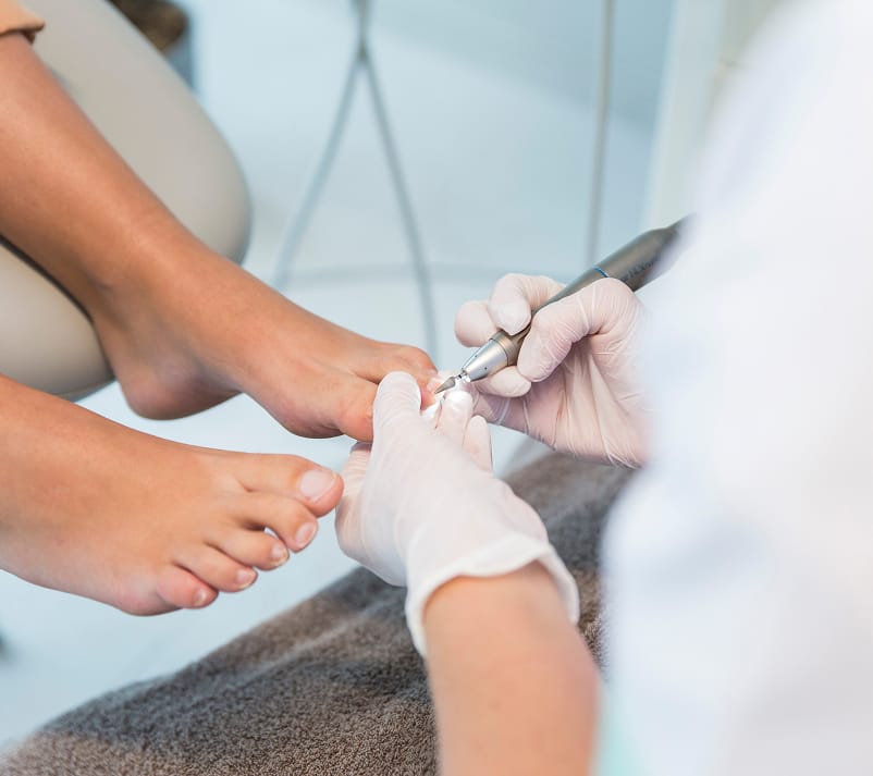 Bij Voetzorg Waas kan je terecht voor gespecialiseerde voetverzorging en behandelingen van uiteenlopende voetproblemen